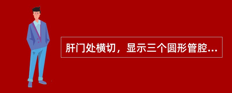肝门处横切，显示三个圆形管腔结构，形如米老鼠，称为"米老鼠"征，下列描述正确的是