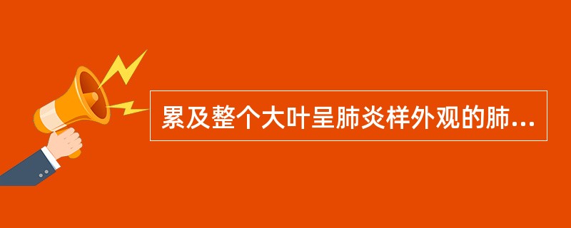 累及整个大叶呈肺炎样外观的肺癌类型是（　　）。