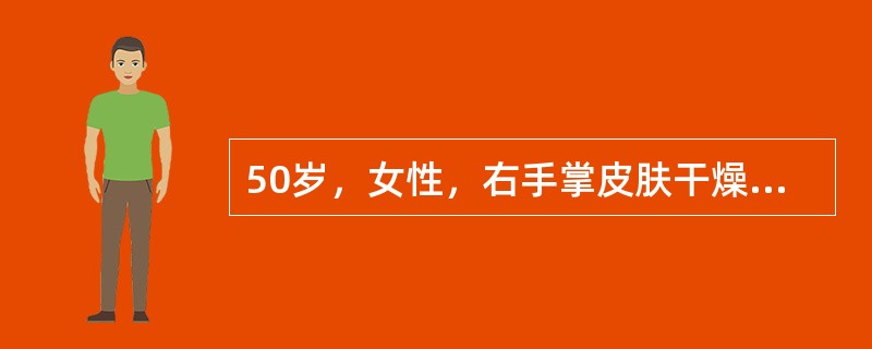 50岁，女性，右手掌皮肤干燥脱屑2年，同时有大拇指、食指甲增厚、变脆，甲下碎屑堆积。<br />下列药物最有效的是