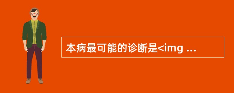 本病最可能的诊断是<img border="0" style="width: 378px; height: 250px;" src="https