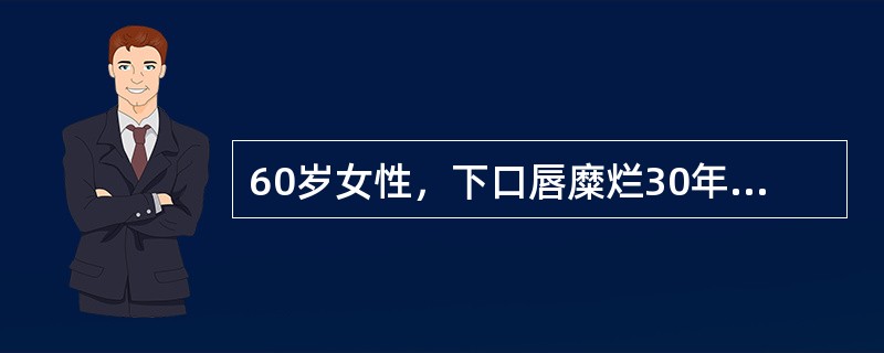 60岁女性，下口唇糜烂30年，诊断为红斑狼疮。1年来下唇出现一肿物。检查发现下唇约2cm×3cm×1cm大小菜花状增生物，伴破溃，有臭味。<br />治疗本病最宜采用