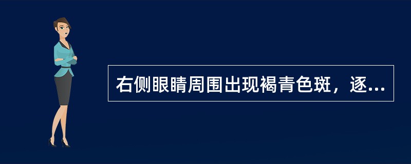 右侧眼睛周围出现褐青色斑，逐渐扩大。查体：右侧上下眼睑、额头部、颧部青灰色斑片，右侧巩膜轻度变蓝。最可能是下列哪项诊断？（　　）
