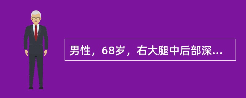 男性，68岁，右大腿中后部深筋膜浅层可见一肿物，大小6.5×5×4cm，切面灰白灰红色，可见坏死，光镜下瘤细胞异形性明显，形态表现为多形性，可见纤维母细胞、多核巨细胞、组织细胞和炎细胞，以瘤巨细胞最多