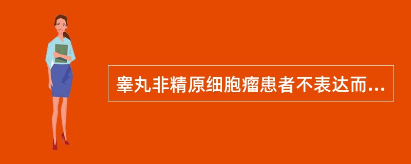 睾丸非精原细胞瘤患者不表达而精原细胞瘤患者表达（　　）。