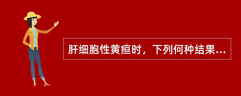 肝细胞性黄疸时，下列何种结果是正确的（　）。