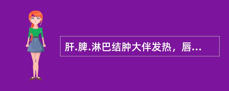 肝.脾.淋巴结肿大伴发热，唇红干裂，结膜充血，指.趾端硬肿，血小板升高，可能为