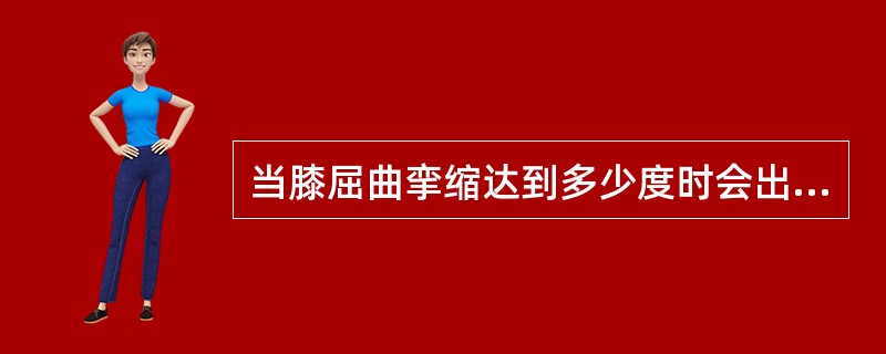 当膝屈曲挛缩达到多少度时会出现短腿步态？（　　）