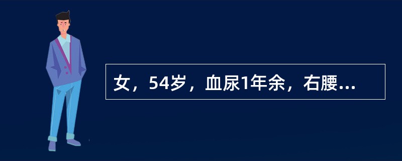 女，54岁，血尿1年余，右腰痛10天余，CT示右肾下极60mm×70mm肿块，突出肾外，中央有不规则低密度区，增强扫描早期病灶明显强化，中心低密度区无强化。最可能的诊断为（　　）。