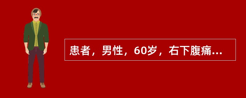 患者，男性，60岁，右下腹痛3个月，有时腹泻，大便隐血试验阳性。钡剂灌肠检查显示升结肠中段一不规则形充盈缺损，局部管壁僵硬，结肠袋消失。最有可能的诊断为（　　）。