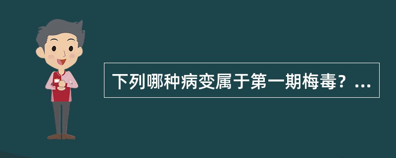下列哪种病变属于第一期梅毒？（　　）