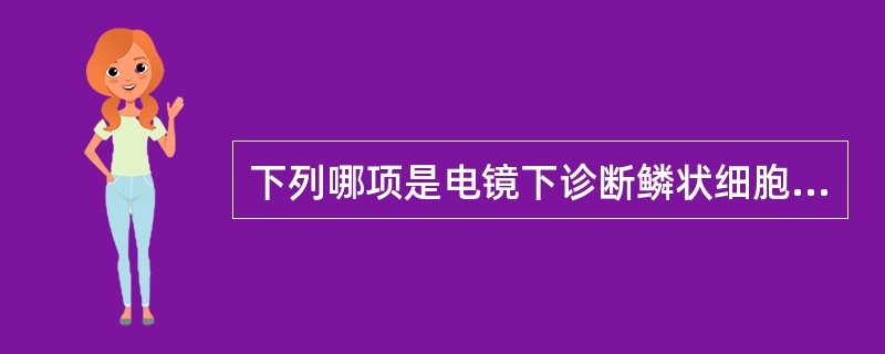 下列哪项是电镜下诊断鳞状细胞癌的主要依据？（　　）