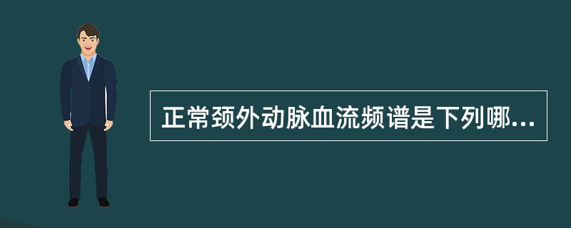 正常颈外动脉血流频谱是下列哪种形态？（　　）