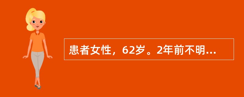 患者女性，62岁。2年前不明原因颜面部及双下肢水肿，在当地疑为肾炎、冠心病予对症治疗无效，且症状渐加重，伴活动后心悸、气短、乏力、食欲减退、腹胀。病史中有情绪低落、反应迟钝、怕冷、脱毛表现。既往无高血