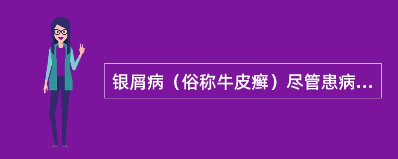 银屑病（俗称牛皮癣）尽管患病率不低，目前认为是一种（　　）。