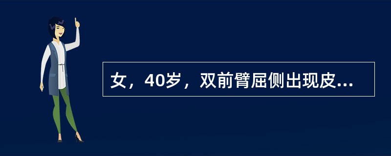 女，40岁，双前臂屈侧出现皮疹半年，伴瘙痒，体检：双前臂屈侧可见散在红色、紫红色多角形扁平丘疹，表面覆白色角质薄膜，有蜡样光泽，口腔里黏膜可见乳白色网状白纹。最可能是下列哪项诊断？（　　）