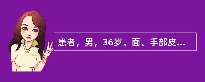 患者，男，36岁。面、手部皮疹1年，1年前冬季开始出现皮疹，皮疹轻度痒，日晒后加重，不伴有其他症状。体格检查：一般情况尚可，系统检查无异常。颧、鼻、外耳、手背部见暗红色斑块，表面附黏着性鳞屑，皮损中央