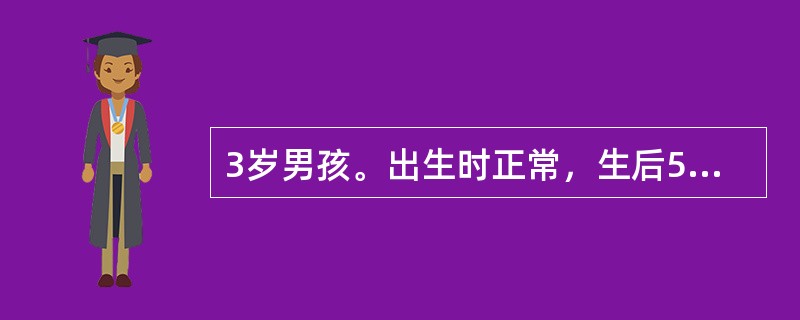 3岁男孩。出生时正常，生后5个月开始出现表情呆滞，有间断癫痫发作，常有呕吐，目前智力明显落后，肌张力增高，头发黄，皮肤白皙。尿有鼠尿臭味。该患儿最可能的诊断是