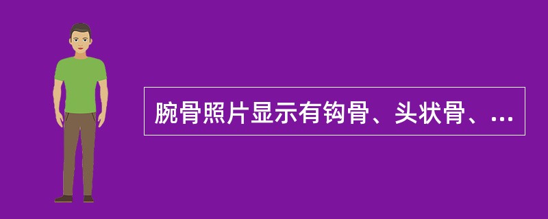 腕骨照片显示有钩骨、头状骨、三角骨，被摄者最可能的年龄
