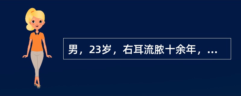 男，23岁，右耳流脓十余年，右外耳道流脓，鼓膜穿孔，CT检查如图，最可能的诊断是（　　）。<br /><img border="0" style="wi