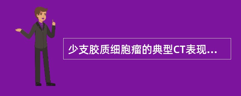 少支胶质细胞瘤的典型CT表现为（　　）。