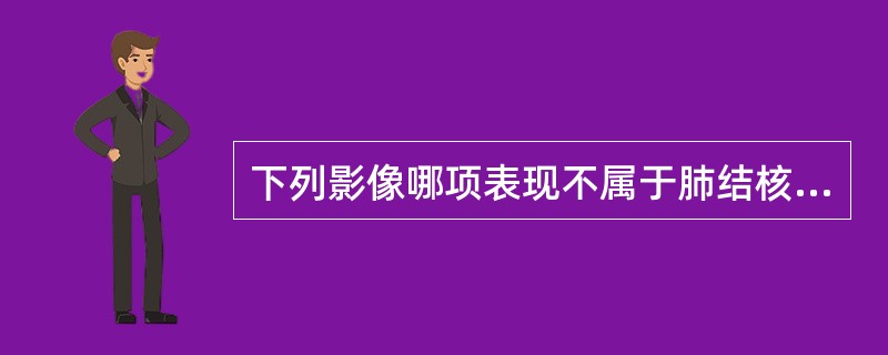 下列影像哪项表现不属于肺结核干酪性病灶（　　）。