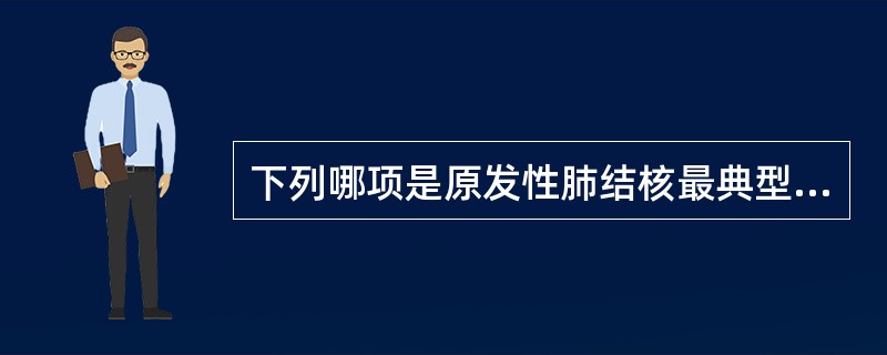 下列哪项是原发性肺结核最典型X线征象（　　）。