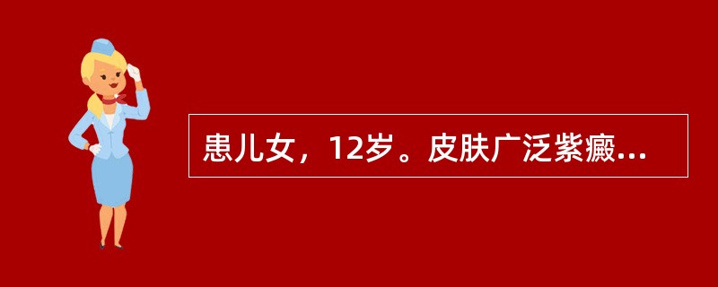 患儿女，12岁。皮肤广泛紫癜伴大量鼻出血1周，病前2周有上呼吸道感染史。体检无特殊发现，实验室检查如下：Hb 80g/L，WBC9.4×109/L，PLT 22×109/L。出血时间11分钟，束臂试验