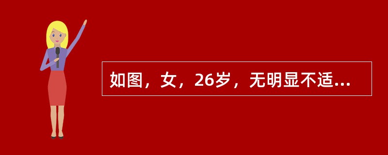 如图，女，26岁，无明显不适，盆腔横断面，最可能的诊断是（　　）。<br /><img border="0" style="width: 418px;