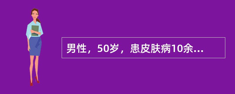 男性，50岁，患皮肤病10余年，反复发作，累及全身。躯干及四肢伸侧分布大小不一的红斑，绿豆大小，斑片状，肘、膝、腰、骶尾部更为明显，皮损边界清楚，红斑表面覆有分层云母样鳞屑；鳞屑易剥除，下方呈发亮淡红