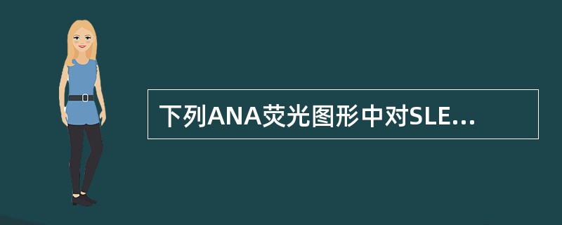 下列ANA荧光图形中对SLE诊断价值最大的是（　　）。