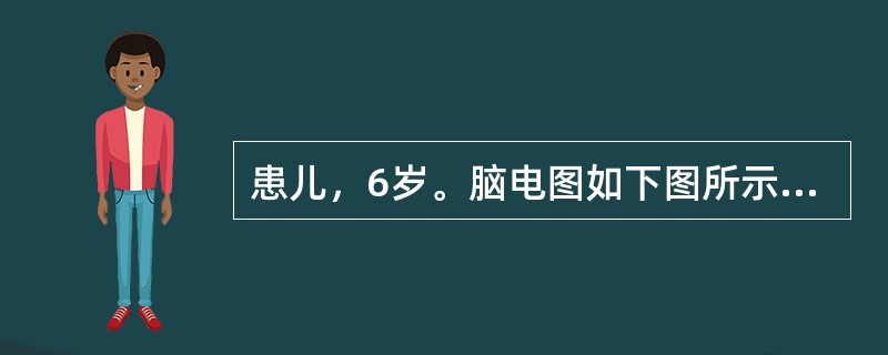 患儿，6岁。脑电图如下图所示，描述正确的是（　　）。<br /><img src="https://img.zhaotiba.com/fujian/20220821/mvg