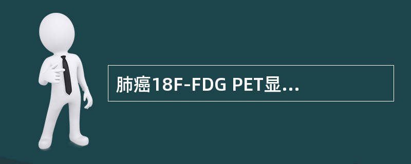 肺癌18F-FDG PET显像，显像前准备是