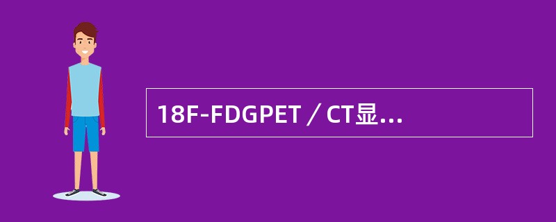18F-FDGPET／CT显像对于淋巴瘤的应用范围有