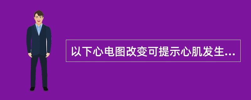 以下心电图改变可提示心肌发生坏死，但应不包括（　　）。