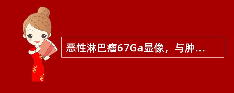 恶性淋巴瘤67Ga显像，与肿瘤组织浓聚相关因素是（　　）。 