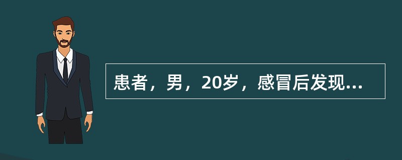 患者，男，20岁，感冒后发现咽痛，颈前部肿大、疼痛，低烧。若血常规检查结果：白细胞升高，血沉快；尿常规阴性，超声显示：甲状腺中度肿大，回声减低，他最可能是（　　）。
