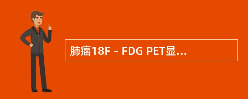 肺癌18F－FDG PET显像时，肿瘤组织摄取显像帮相关因素有（　　）。 