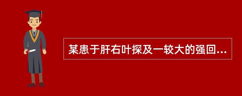 某患于肝右叶探及一较大的强回声团块，强回声区内可见形态不规则无回声区，强回声周边可见低回声晕环绕，CDFI示团块内部及周边可见多条状和簇状彩色血流分布，PD示为动脉频谱Vmax为70cm/s。则下列哪