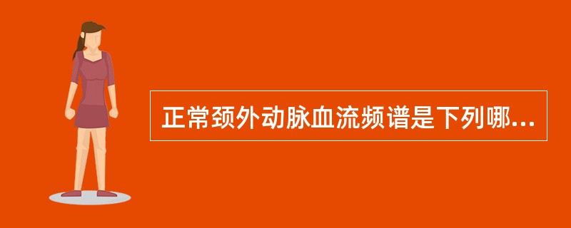 正常颈外动脉血流频谱是下列哪种形态（）