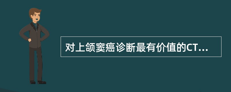 对上颌窦癌诊断最有价值的CT征象为（）