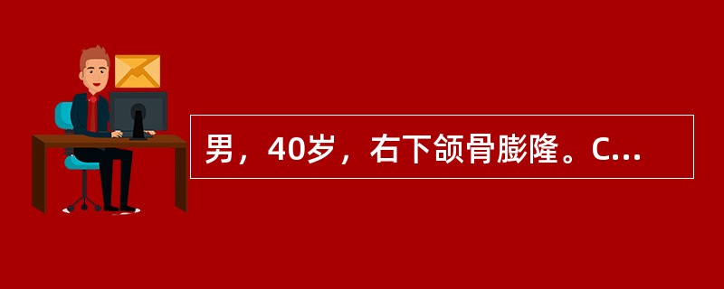 男，40岁，右下颌骨膨隆。CT示下颌角有-2.5×3cm囊实性肿块，分叶。最大可能是（）