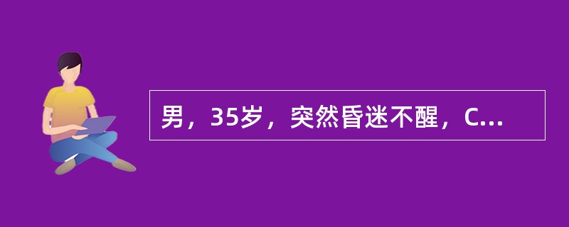 男，35岁，突然昏迷不醒，CT示右侧侧裂池，颞角呈铸形高密度，诊断（）