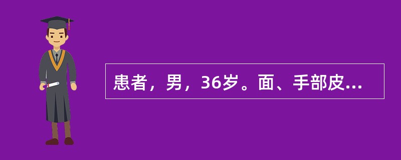 患者，男，36岁。面、手部皮疹1年，1年前冬季开始出现皮疹，皮疹轻度痒，日晒后加重，不伴有其他症状。体格检查：一般情况尚可，系统检查无异常。颧、鼻、外耳、手背部见暗红色斑块，表面附黏着性鳞屑，皮损中央