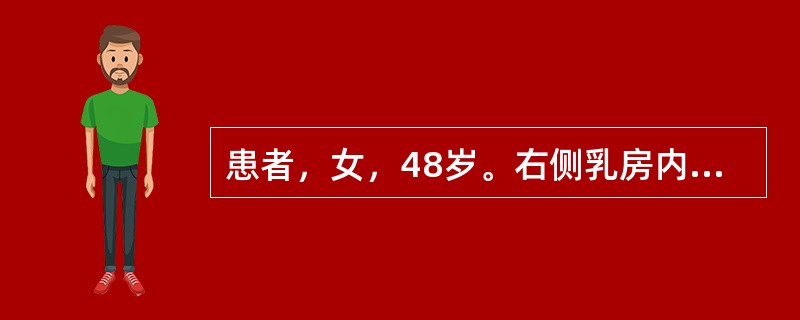 患者，女，48岁。右侧乳房内无痛性肿块2个月。体检：右侧乳房外上象限可扪及一直径约为4cm的肿块，表现不甚光滑，边界不清，质地硬；局部乳房皮肤凹陷呈“酒窝征”；同侧腋窝可扪及2个肿大的淋巴结，可被推动