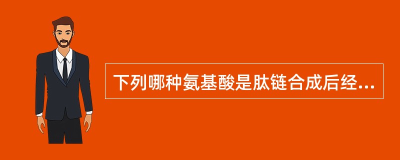 下列哪种氨基酸是肽链合成后经加工才出现在蛋白质中的？（）