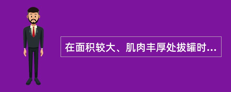 在面积较大、肌肉丰厚处拔罐时，多选用（）