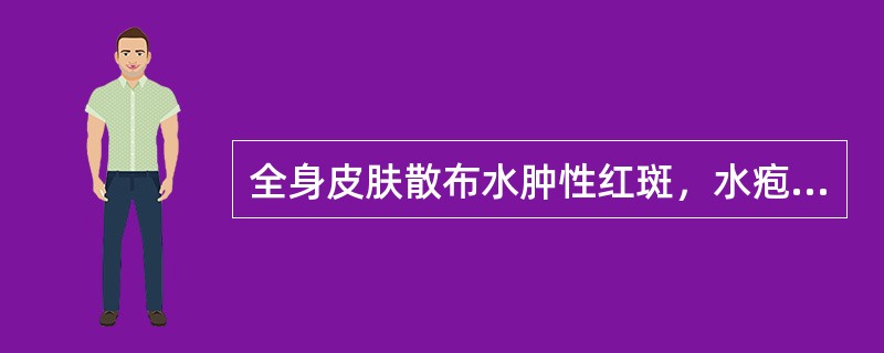 全身皮肤散布水肿性红斑，水疱、大疱及血疱。其诊断是（）