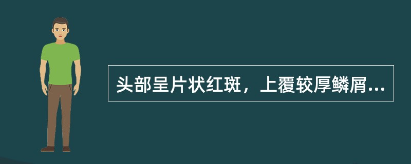 头部呈片状红斑，上覆较厚鳞屑，抓之呈点状出血，皮损超过发际（）