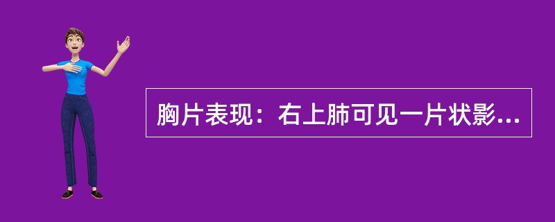 胸片表现：右上肺可见一片状影、絮状阴影，边缘模糊，应诊断为（　　）。 