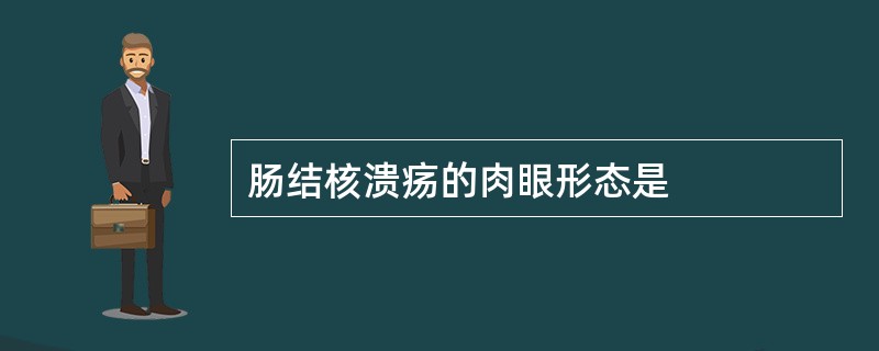 肠结核溃疡的肉眼形态是